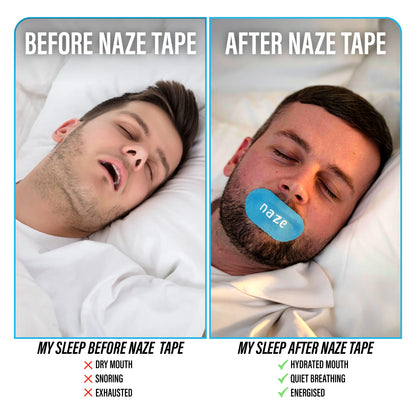 Naze Mouth Tape